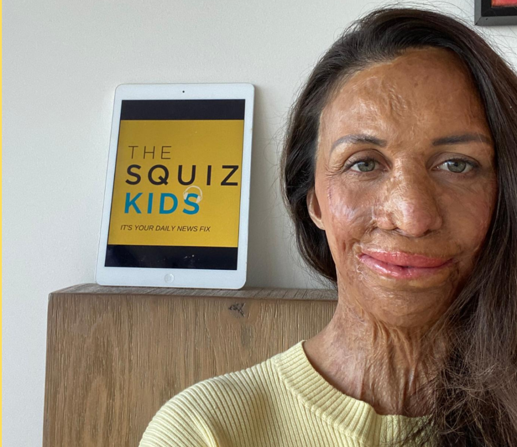 Squiz Kids Specials_Turia Pitt Squiz Kids Specials_Turia Pitt