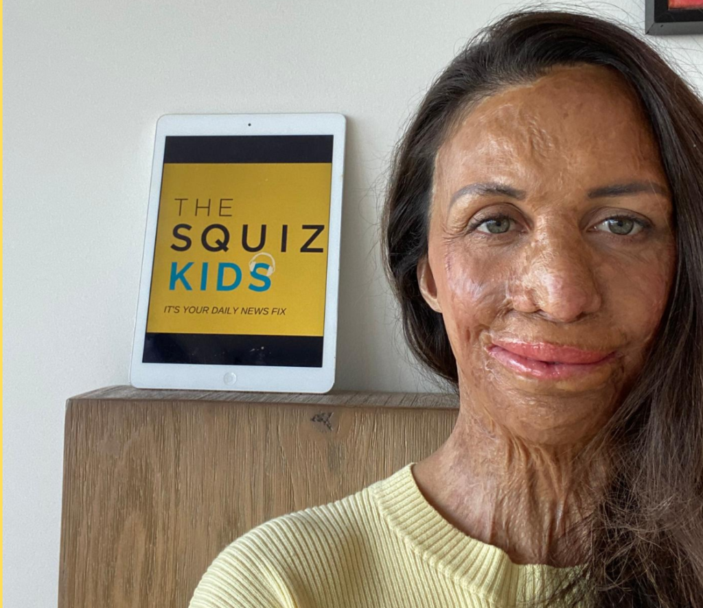 Squiz Kids Specials_Turia Pitt